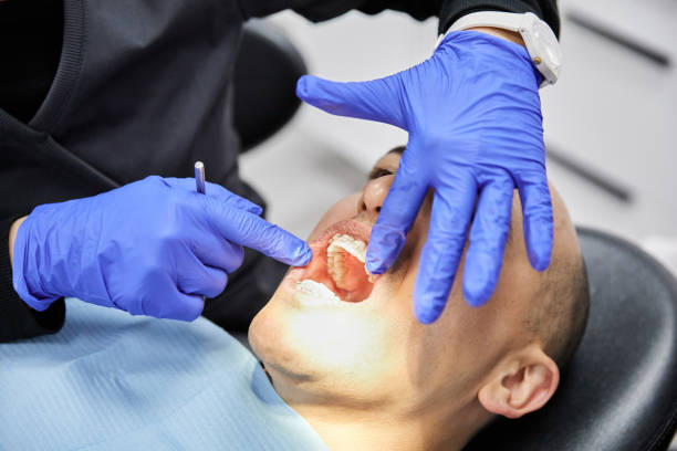 Best Lost Filling or Crown Replacement in Louisvle, IL