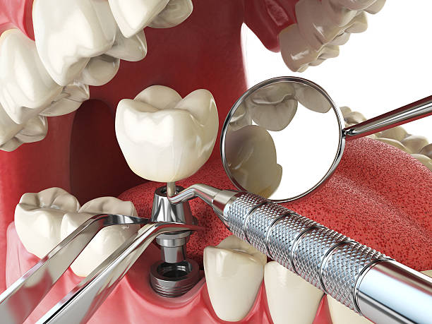 Best 24-Hour Emergency Dental Care in Louisvle, IL